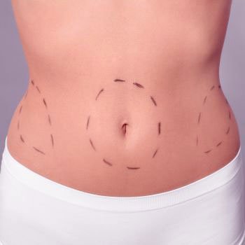 Especialista em Cirurgia Plástica de Corpo em Curitiba