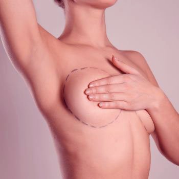 Especialista em Cirurgia Plástica de Mama em Curitiba