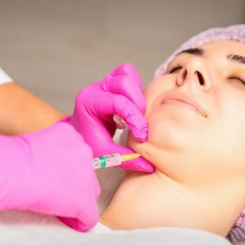 Lipoaspiração de Submento (papada)