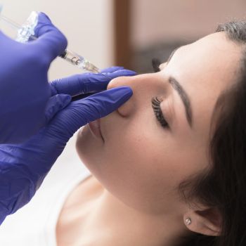 Rinoplastia