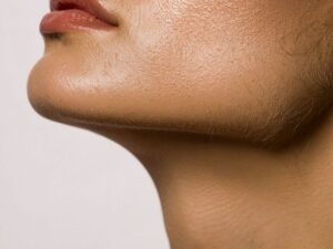 Lipo de Papada em Curitiba Definicao do Contorno Cervical