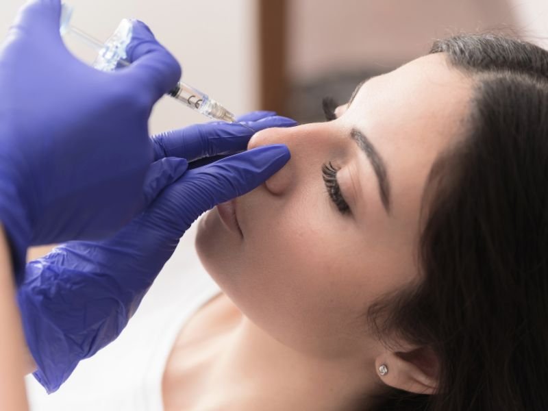 Cirurgia Plastica Rinoplastia em Curitiba